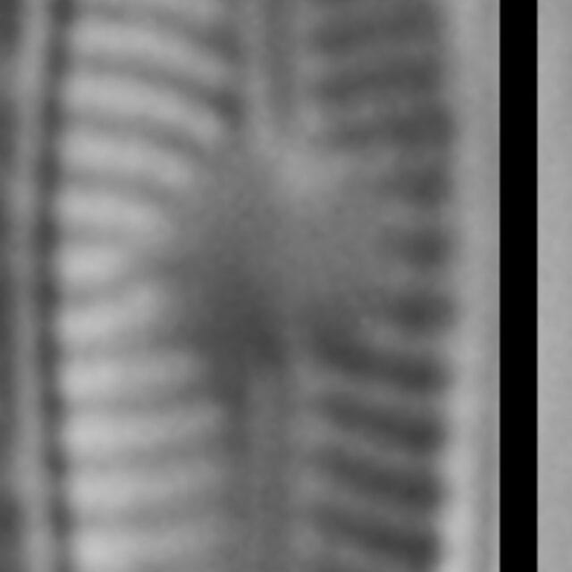 Genkalia digituloides LM5