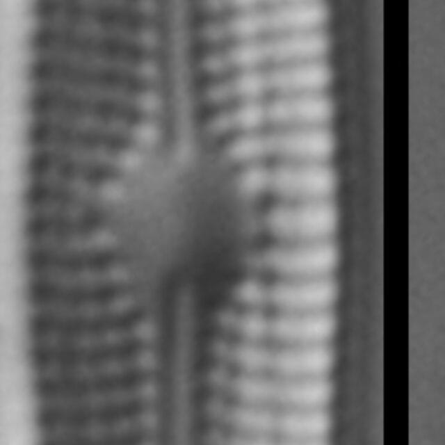 Genkalia digituloides LM6