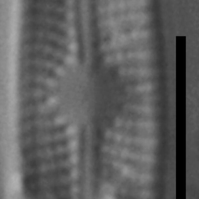 Genkalia digituloides LM1