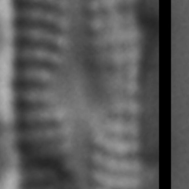 Genkalia digituloides LM7