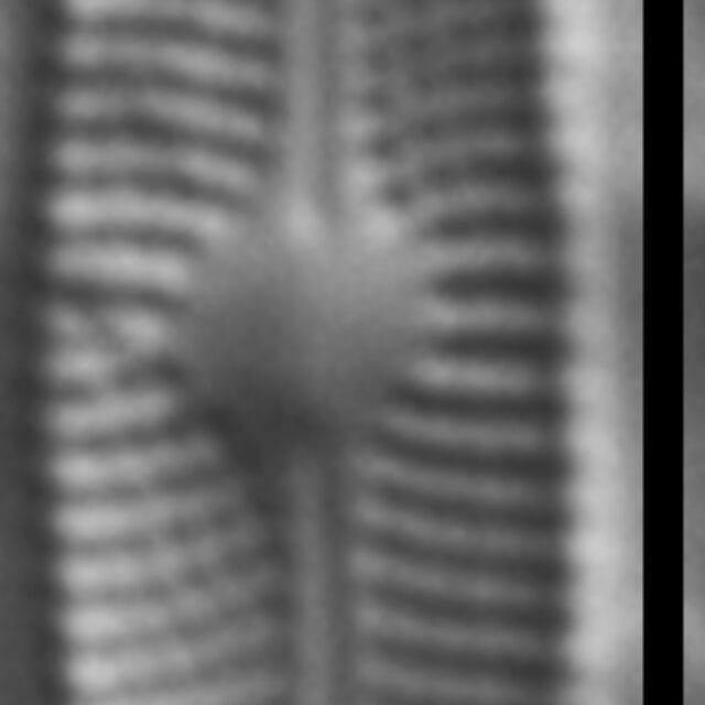 Genkalia digituloides LM3