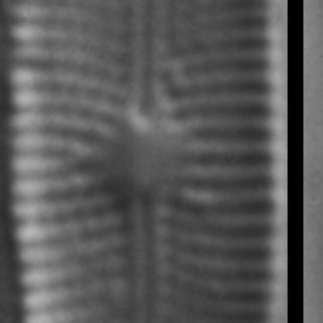 Genkalia digituloides LM4