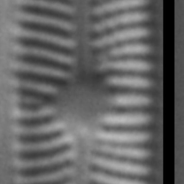 Genkalia digituloides LM2