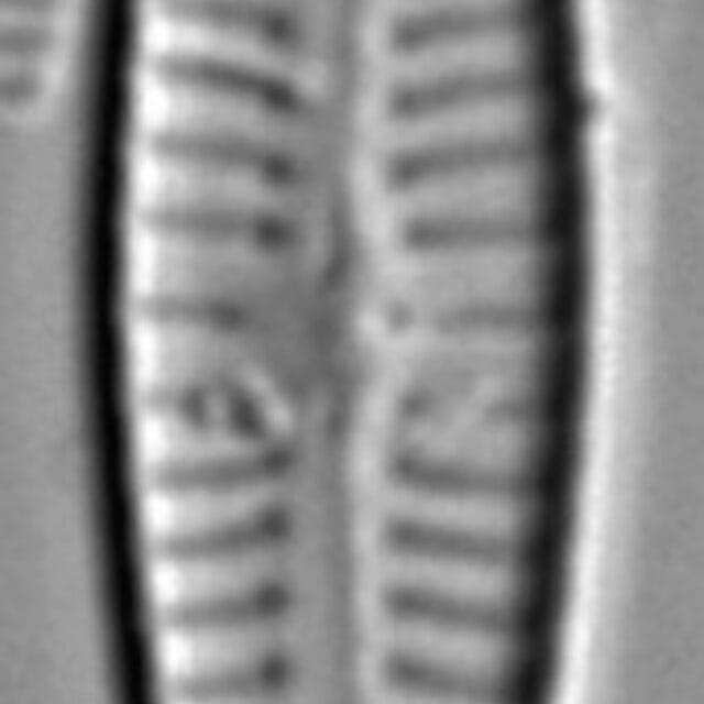 Gomphonema Intricatum Var Vibrio Lm7