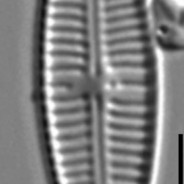 Gomphonema Lagenula LM3