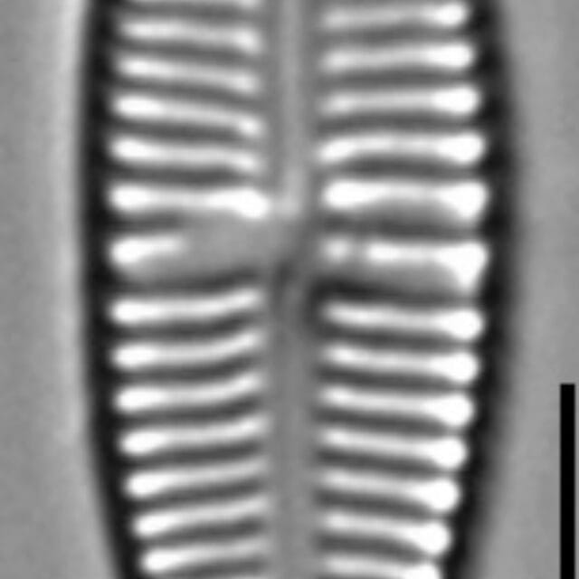 Gomphonema Lagenula LM4
