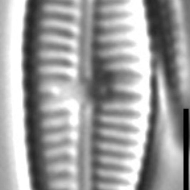 Gomphonema Lagenula LM5