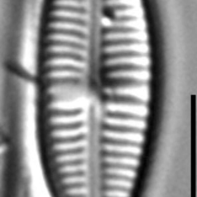 Gomphonema Lagenula LM7