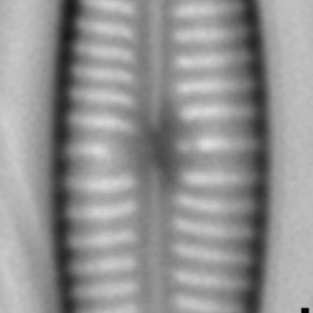 Gomphonema Lagenula LM1