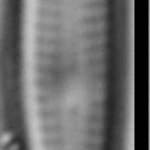 Gomphosphenia Tackei Var Brevistriatum 100X B2  Gc53756