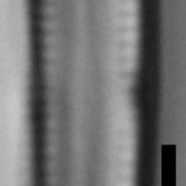 Gomphosphenia Tackei Var Brevistriatum 100X M  Gc53756