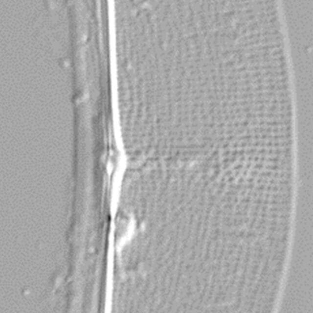 Halamphora baleenicola LM1