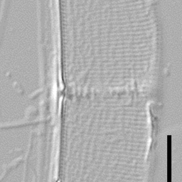 Halamphora baleenicola LM5