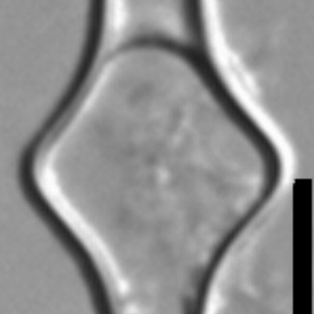 Kan2  Strain Iv  Girdle  Cropped