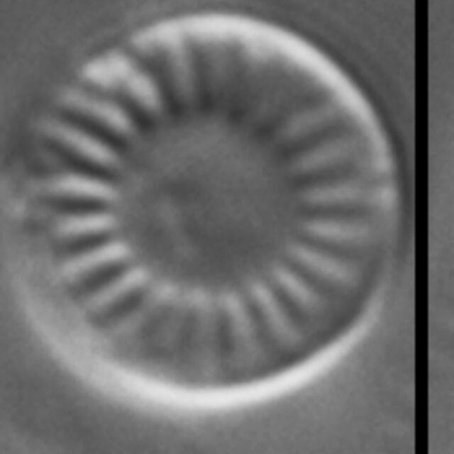 Discostella lacuskarluki LM1