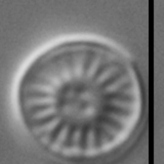 Discostella lacuskarluki LM3