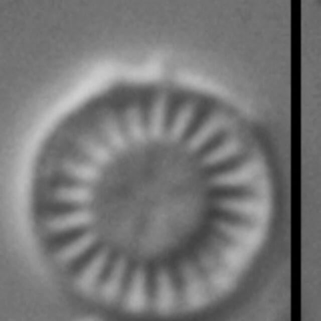 Discostella lacuskarluki LM4