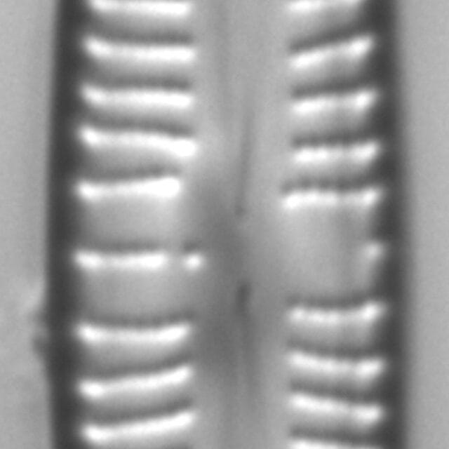 Kurtkrammeria Coxiae 459401 4