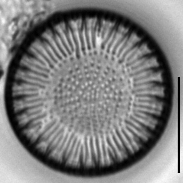 Lindavia bodanica LM4