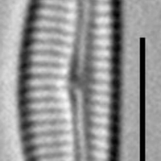 Encyonema evergladianum LM6