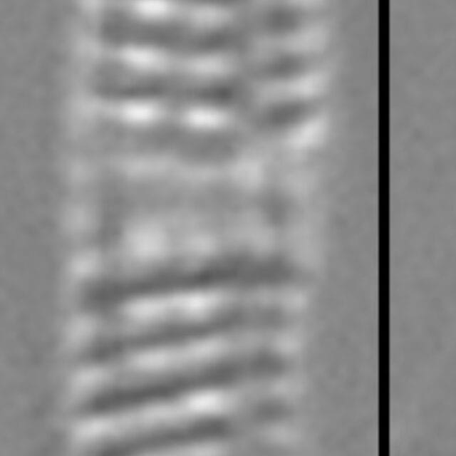 Medlinella amphoroidea LM1