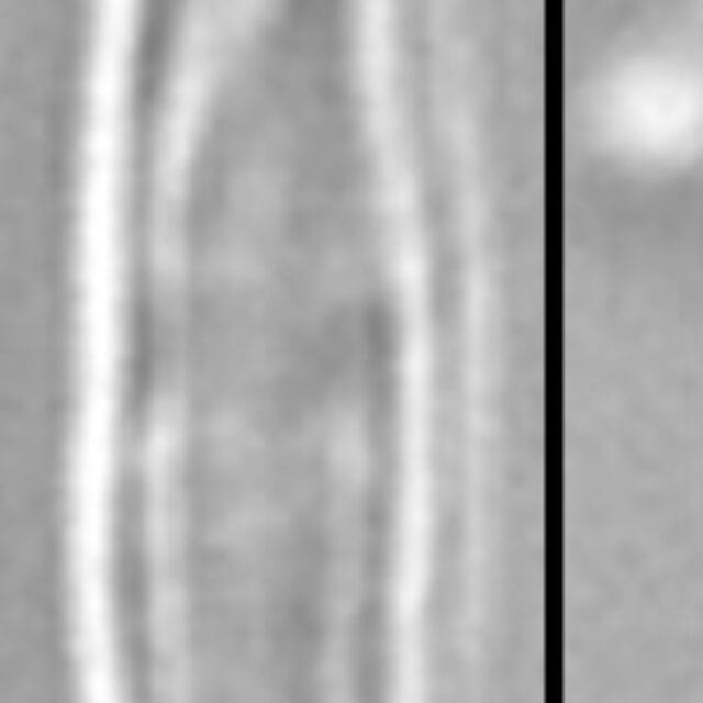 Medlinella amphoroidea LM2