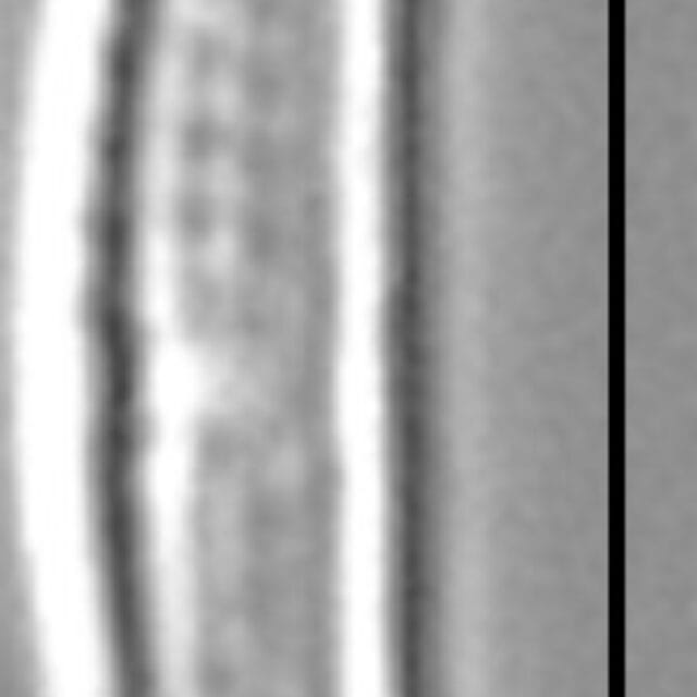 Medlinella amphoroidea LM3