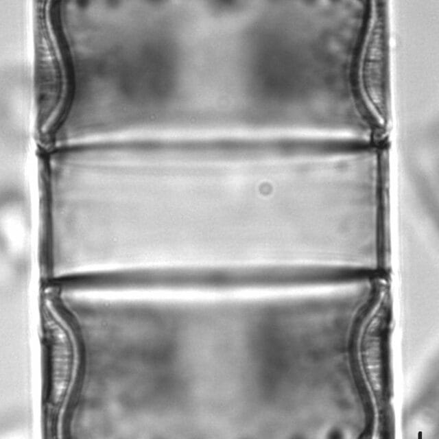Melosira undulata LM4
