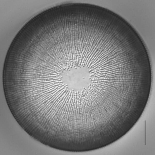 Melosira undulata LM5