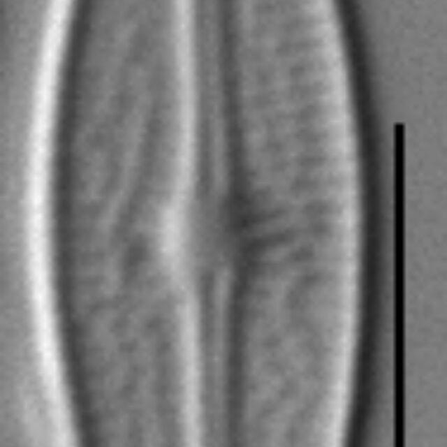 Brachysira microcephala LM3