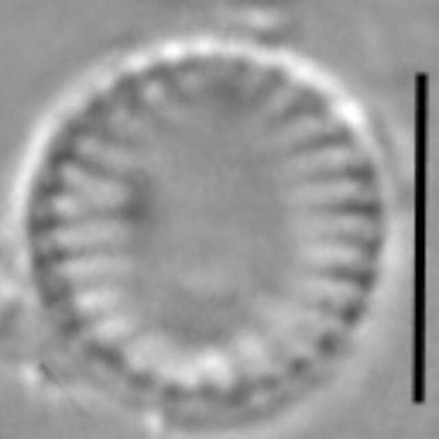 Nanofrustulum cataractarum LM2