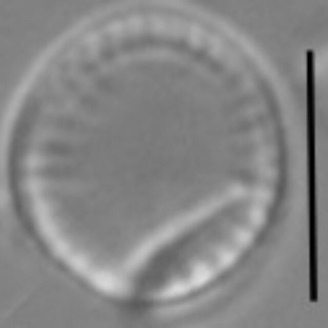 Nanofrustulum cataractarum LM4