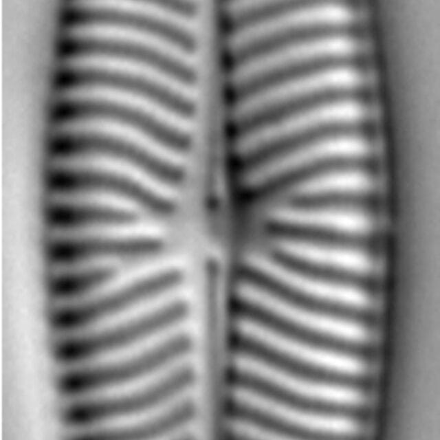 Navicula capitatoradiata LM1