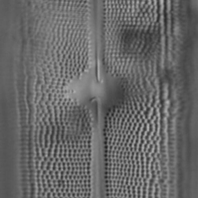 Neidium amphigomphus LM6