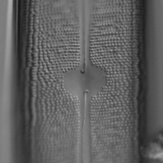 Neidium amphigomphus LM7