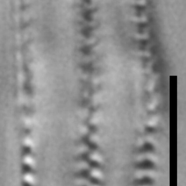 Ninastrelnikovia gibbosa LM9