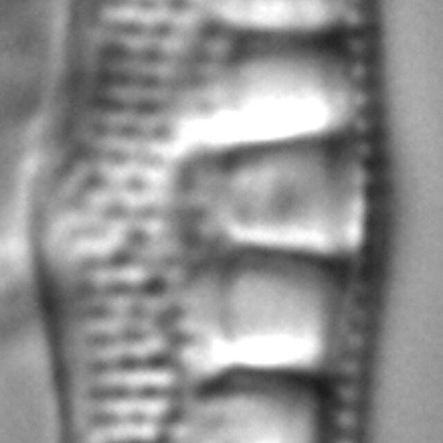 Nitzschia sinuata LM2