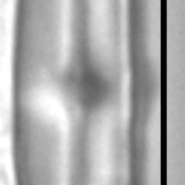 Nupela tenuicephala LM3