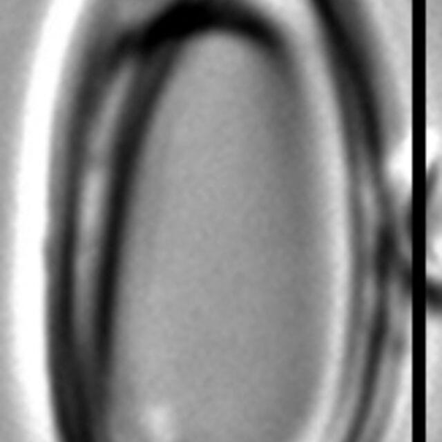 Oxyneis binalis var elliptica LM2