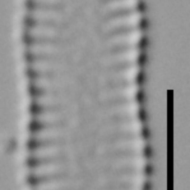 Pseudostaurosira_parasitica_var_subconstricta_LM5