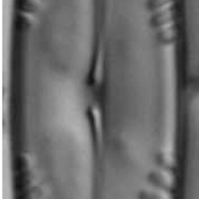 Pinnularia subgibba var undulata LM5