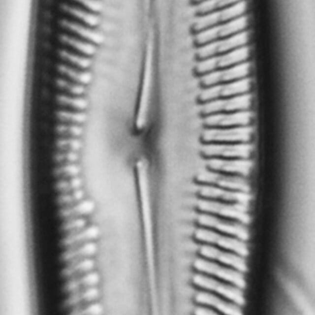Pinnularis transversa LM7