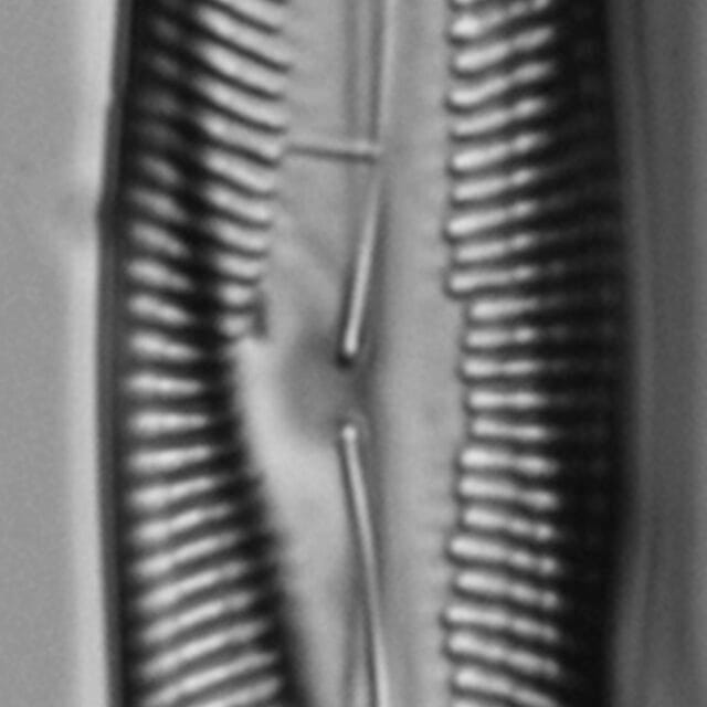 Pinnularis transversa LM6