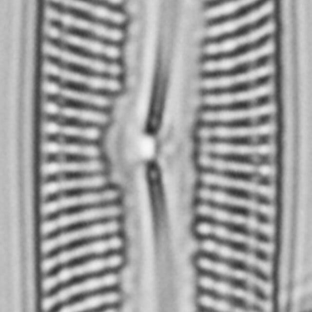 Pinnularis transversa LM3