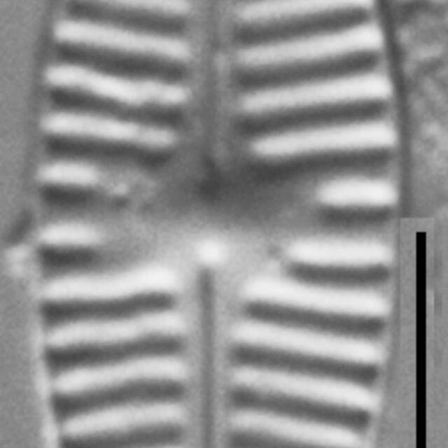 Planothidium Incuriatum Lm6