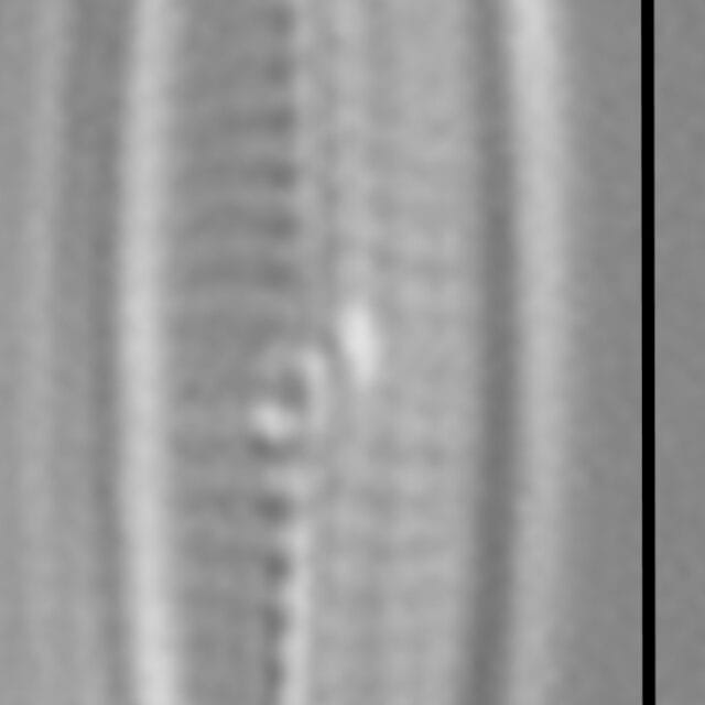 Proschkinia vergostriata LM3