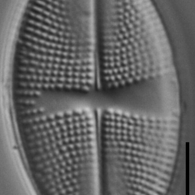 Psammothidium obliquum LM7