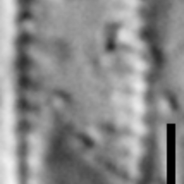 Pseudostaurosira microstriata LM2