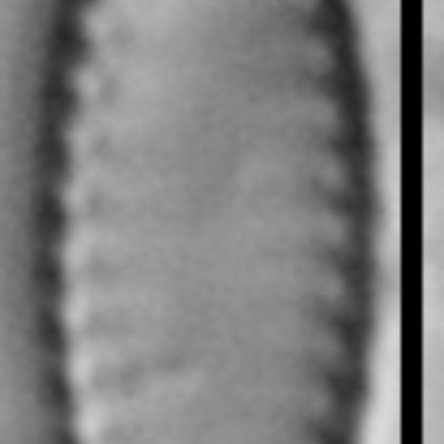 Pseudostaurosira microstriata LM3