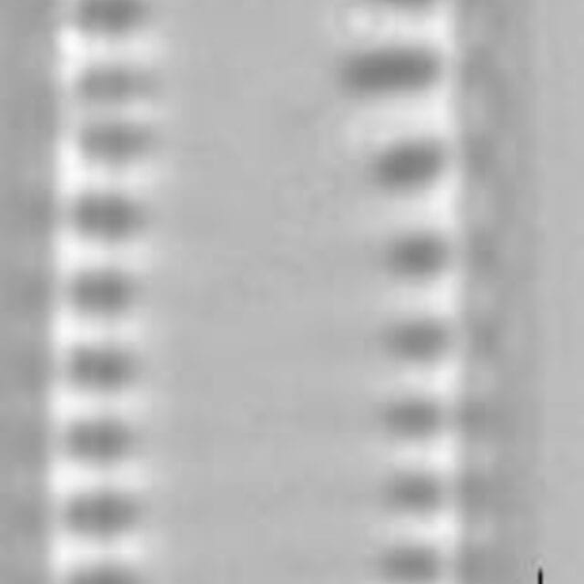 Pseudostaurosira brevistriata LM3
